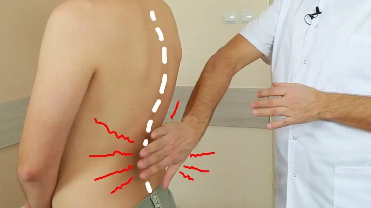 Ból nerek gdzie boli – poznaj objawy i lokalizację bólu nerek