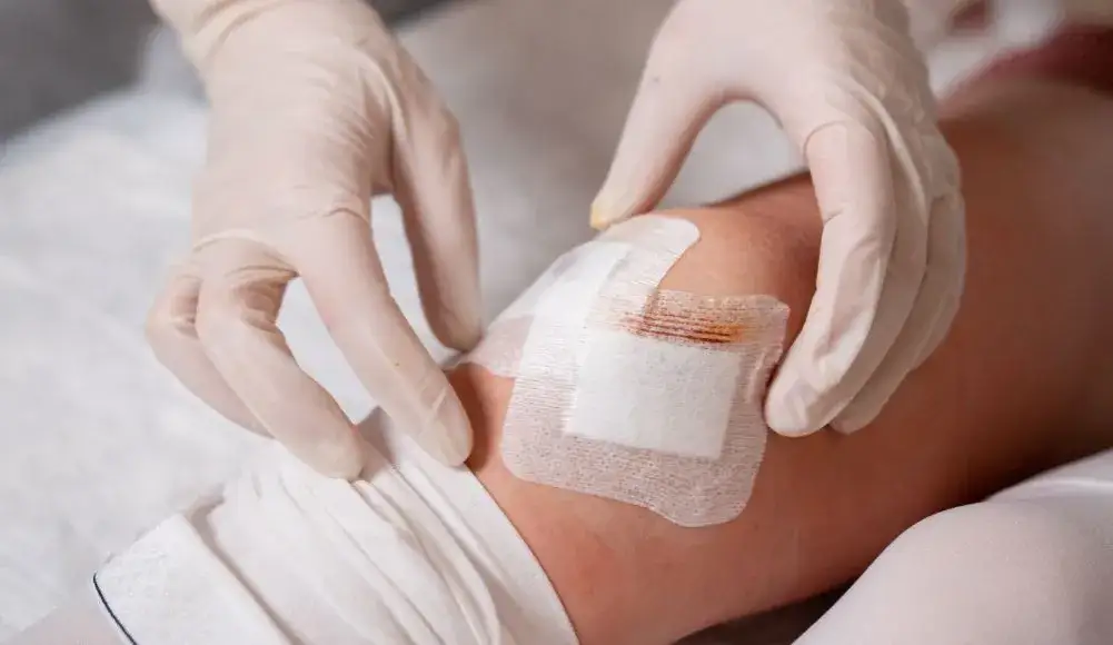 Ile trwa rehabilitacja po artroskopii kolana? Poznaj kluczowe informacje