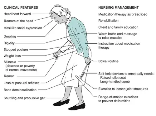 Choroba Parkinsona: jakie badania? Diagnoza krok po kroku
