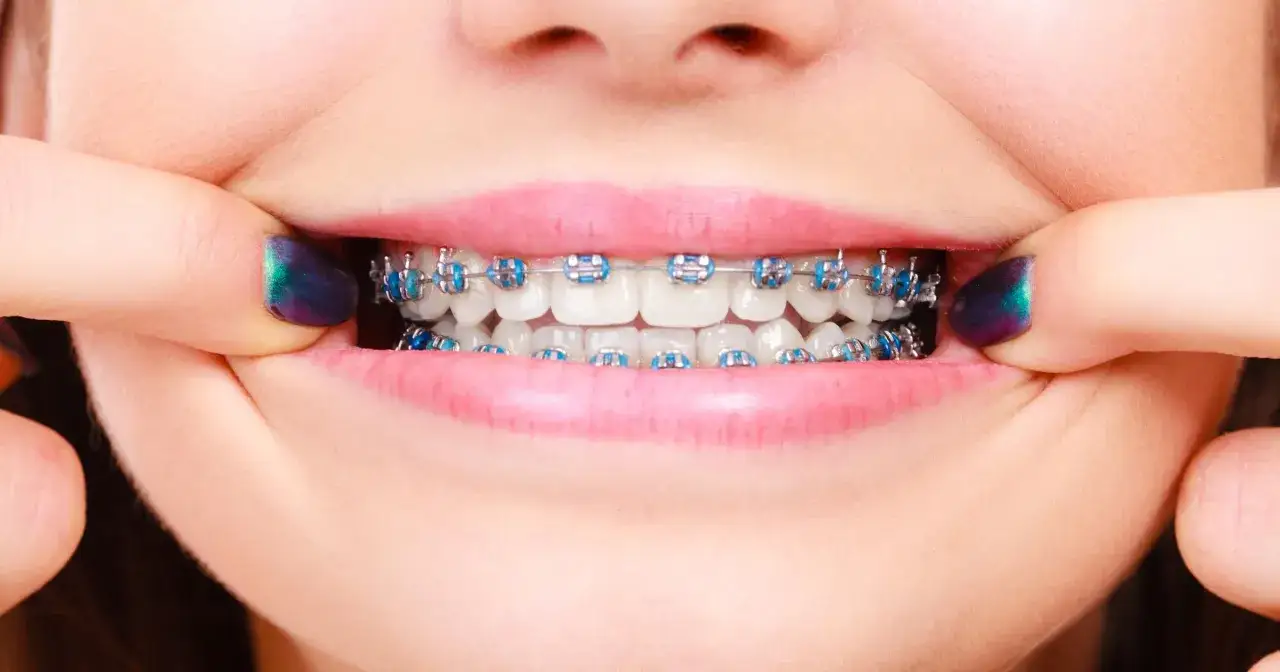 Czy ortodonta to dentysta? Poznaj kluczowe różnice i wybierz specjalistę