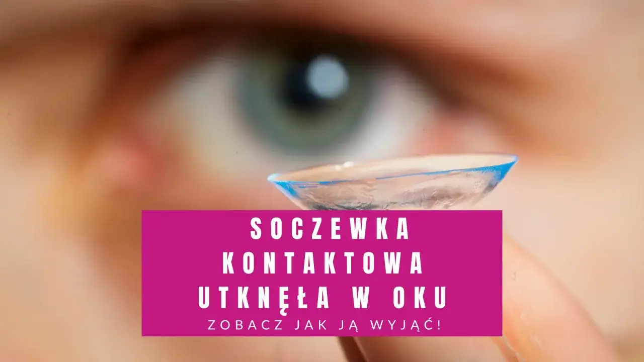 Nie mogę znaleźć soczewki w oku? Zobacz, jak wyjąć soczewkę kontaktową, która utknęła w oku.