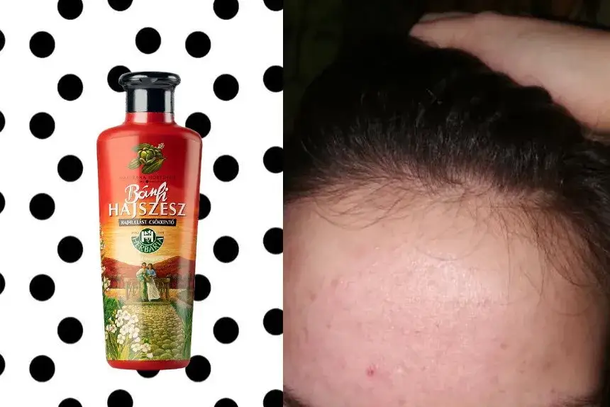 Wcierka do włosów przed czy po myciu - co wybrać dla najlepszych efektów?