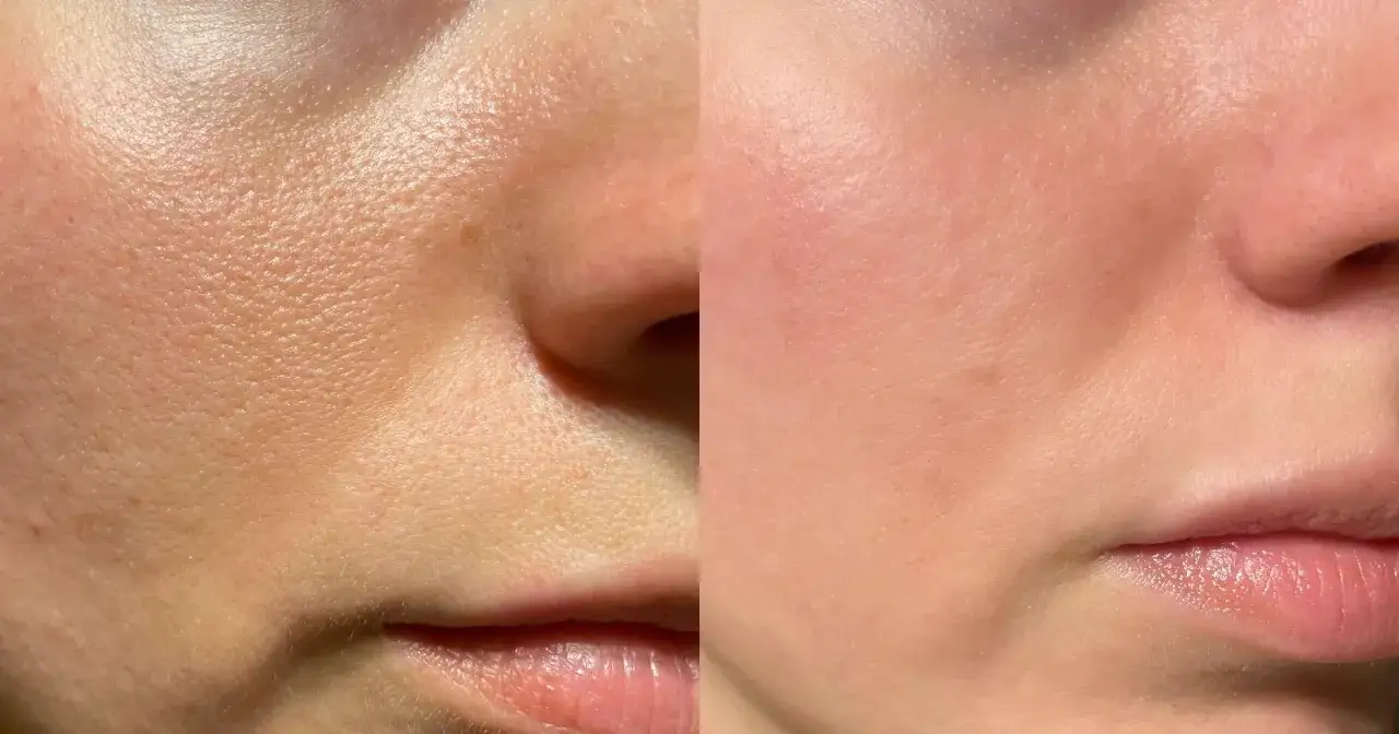 Krem BB czy podkład? Wybierz idealny dla Twojej cery!