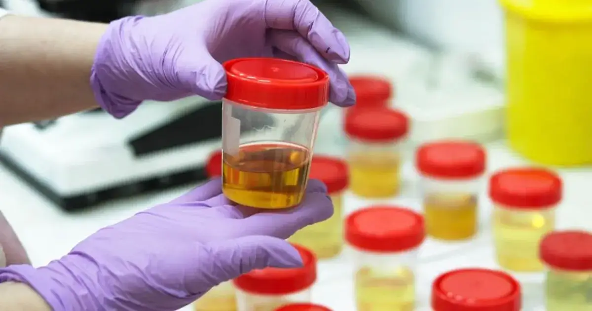 Ile kosztuje badanie moczu? Ceny, które mogą Cię zaskoczyć