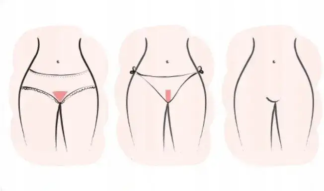 Jak złagodzić podrażnienia po goleniu miejsc intymnych skutecznie