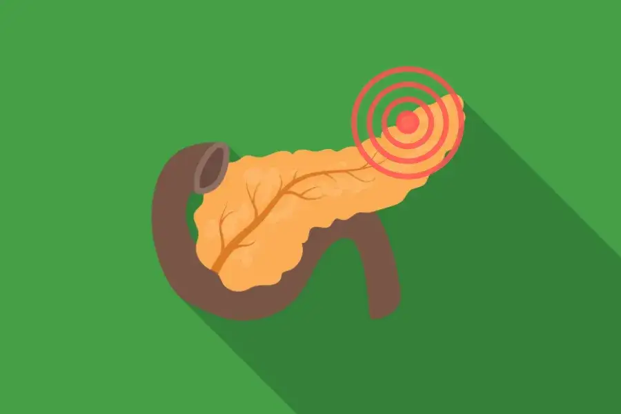 Niedobór enzymów trzustkowych objawy – jak je rozpoznać i leczyć