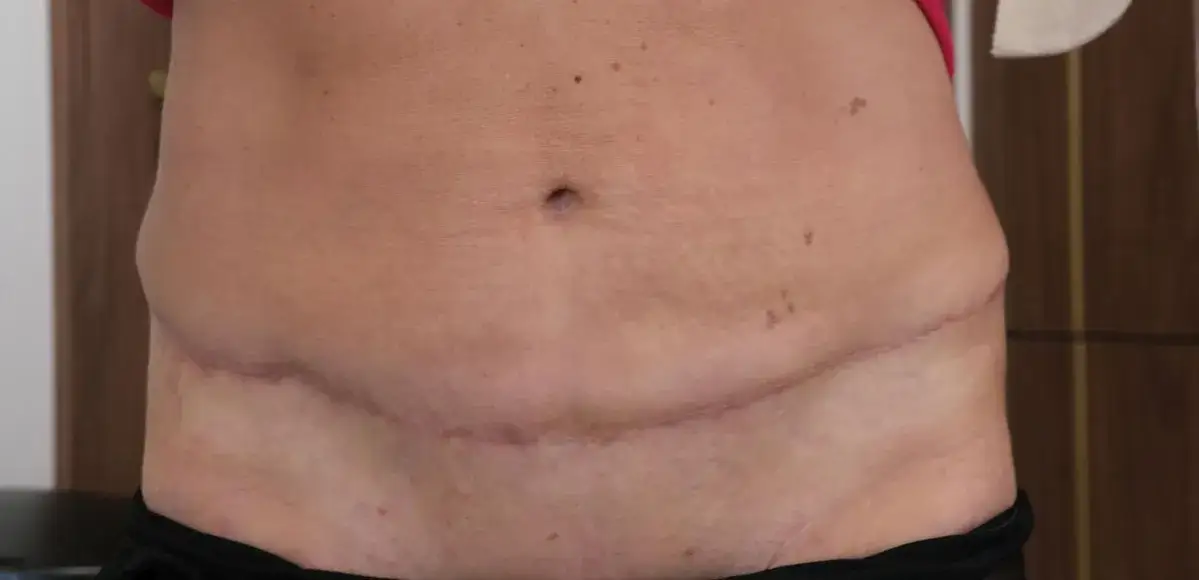 Sennik Operacja Brzucha - Sen o Operacji i Sennik Operacja Oczu