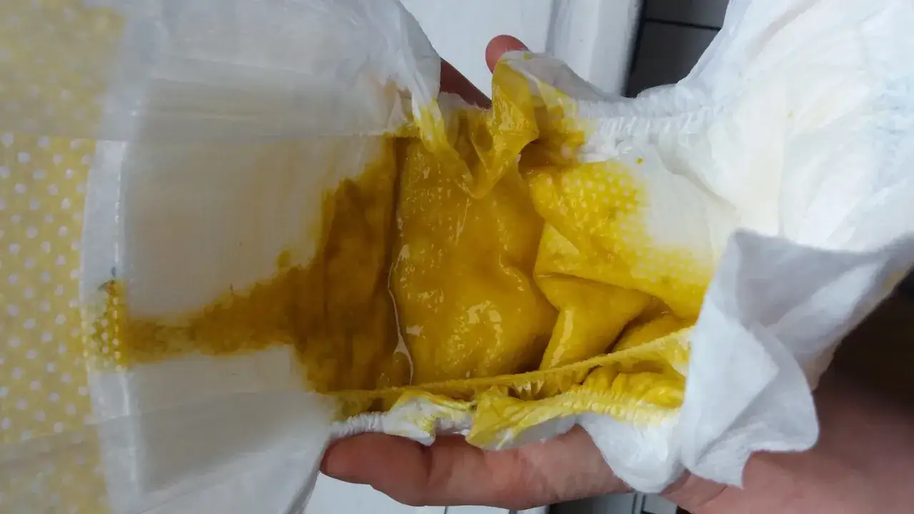 Niemowlę ma zaparcia? Sprawdzone sposoby i kiedy do lekarza