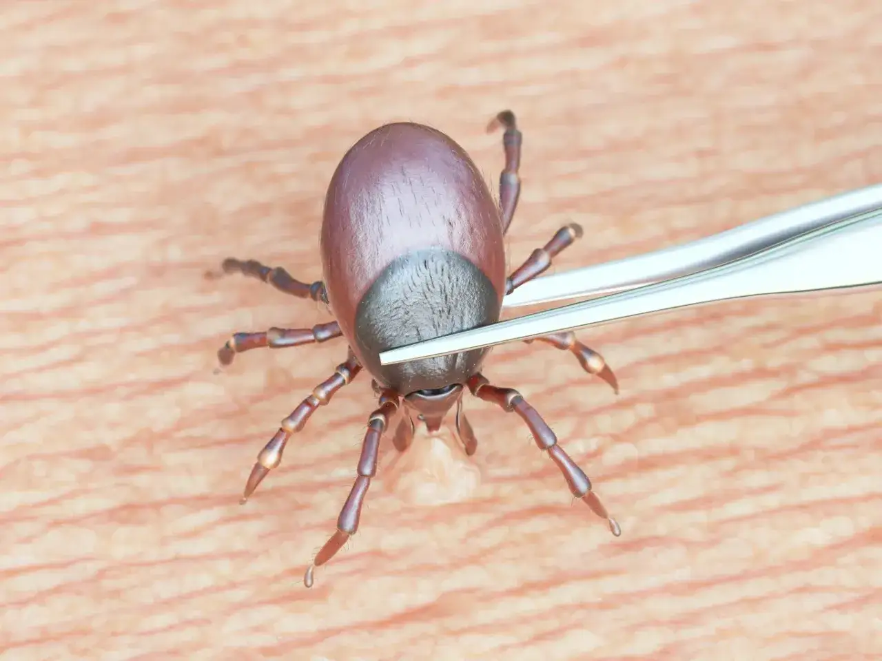 Kleszcz pęsetą: Usuń bezpiecznie! Uniknij błędów i chorób.