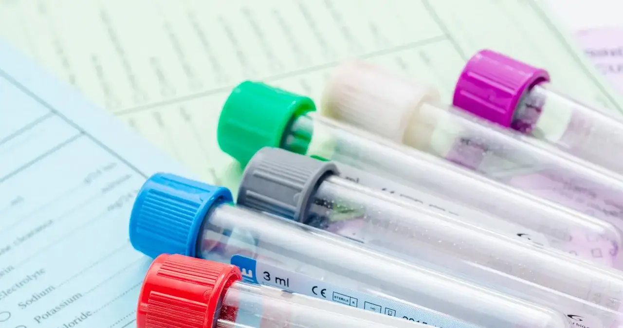 Ile jest ważne skierowanie na badanie krwi NFZ? Sprawdź, zanim przepadnie