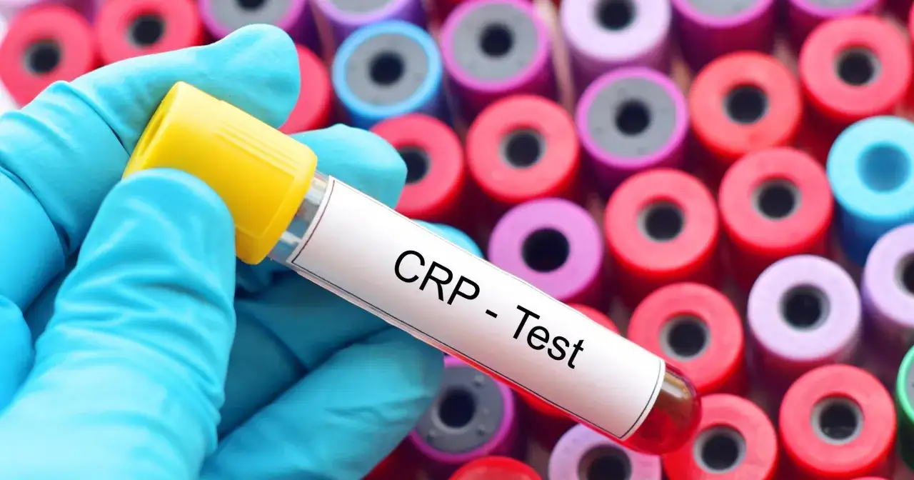 Podwyższone CRP: Co oznacza? Przyczyny, normy, kiedy do lekarza?