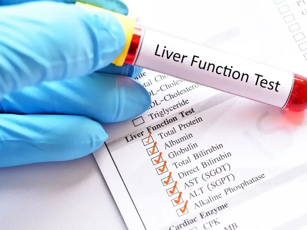 Badanie ALT: Rozszyfruj wyniki i zadbaj o zdrowie wątroby