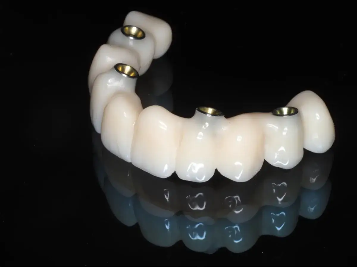 Zęby w dolnej szczęce: ile ich jest? Od 10 do 16 poznaj różnice.