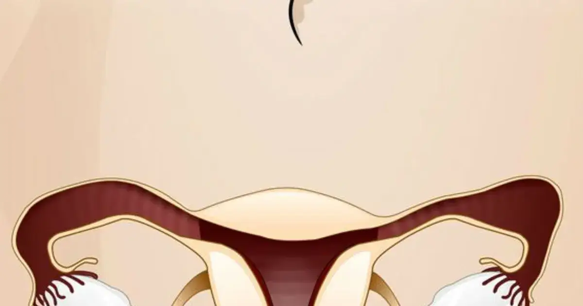 Jakie leki na zapalenie jajników skutecznie złagodzą ból i objawy