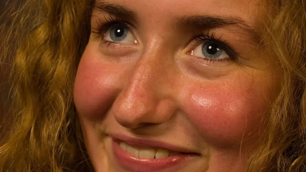 ¿Rubor facial por tus medicamentos? Soluciones y control experto