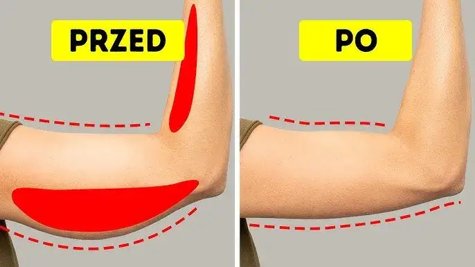Jak skutecznie odchudzić ramiona – ćwiczenia, dieta i unikanie błędów