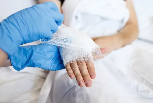 Kiedy zacząć rehabilitację po operacji cieśni nadgarstka, aby uniknąć bólu?