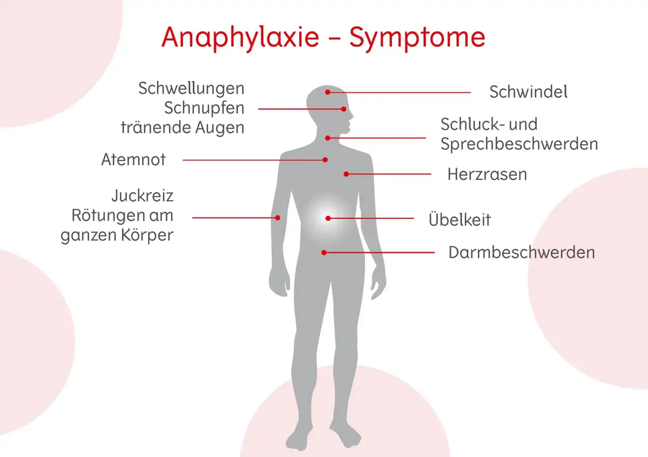 Allergie Symptome: So erkennen Sie gefährliche Reaktionen rechtzeitig