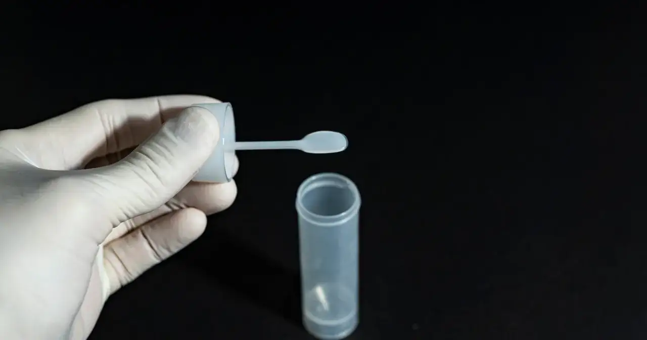 Jak oddać kał do badania Sanepid – krok po kroku, koszty i czas oczekiwania