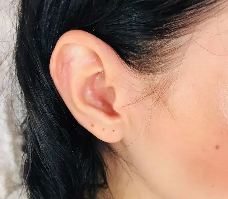 Jak zdjąć kolczyki pierwsze bez bólu i ryzyka uszkodzenia skóry