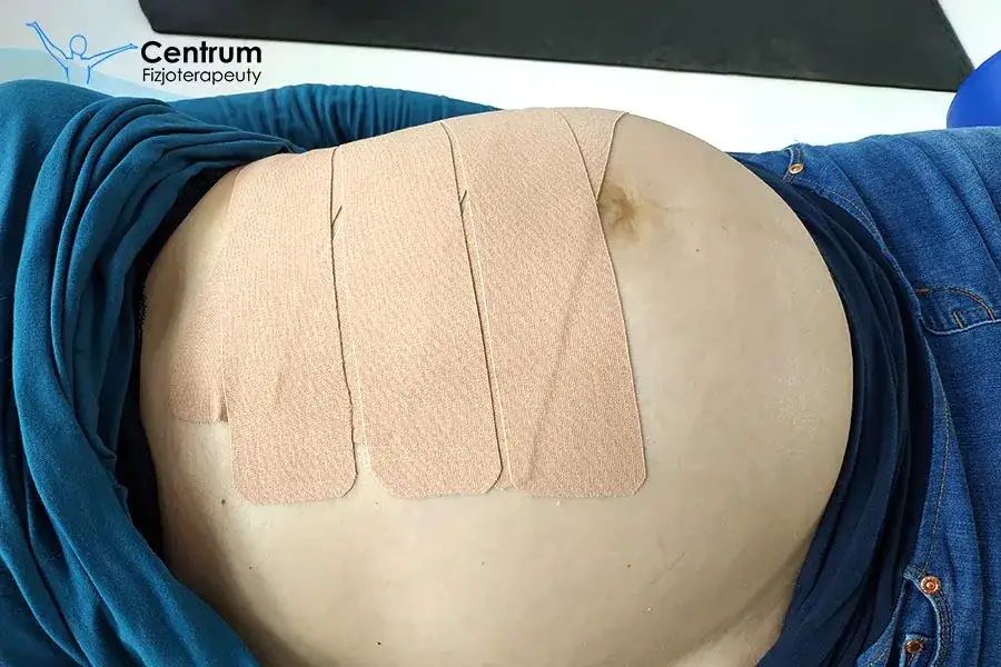 Jakie ćwiczenia przy przepuklinie pępkowej pomogą uniknąć bólu?