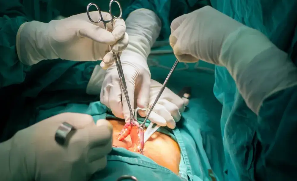 Jak złagodzić ból wyrostka robaczkowego i uniknąć poważnych problemów