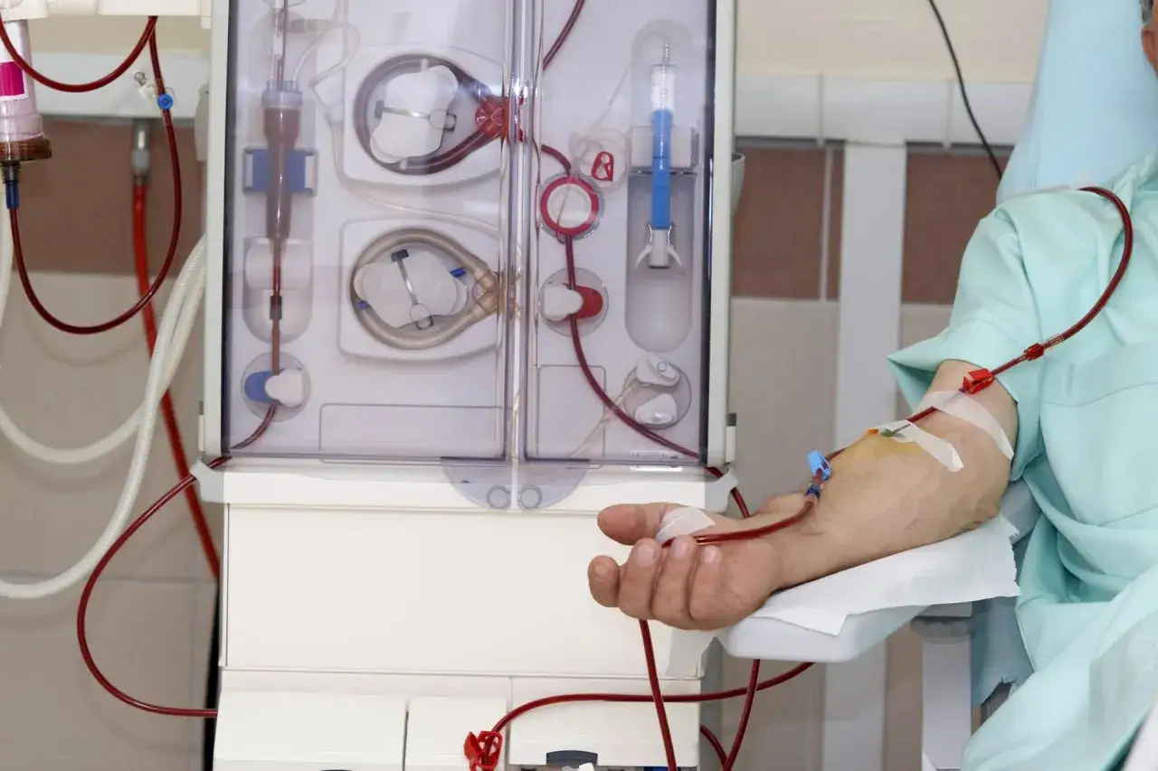 Pacjent podłączony do aparatu do dializy. Czerwone przewody doprowadzają krew do maszyny, która oczyszcza ją. To właśnie dializa co to jest w praktyce.