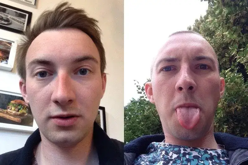 Czy łysina Ci pasuje? Sprawdź, zanim ogolisz głowę!