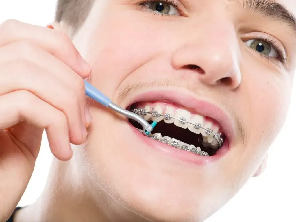 Czy aparat ortodontyczny piszczy na lotnisku? Oto, co musisz wiedzieć