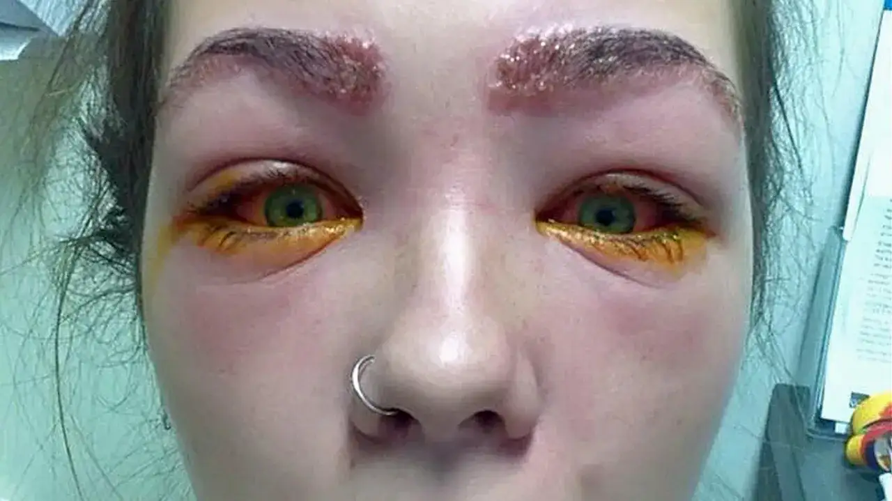 Nieudana henna brwi - Jak naprawić, zmyć i uniknąć alergii