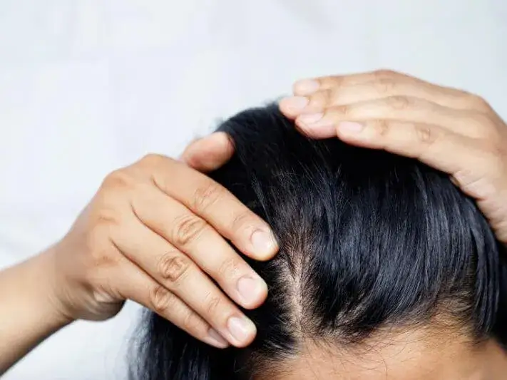 Jak zrobić peeling do skóry głowy, aby uniknąć problemów z włosami
