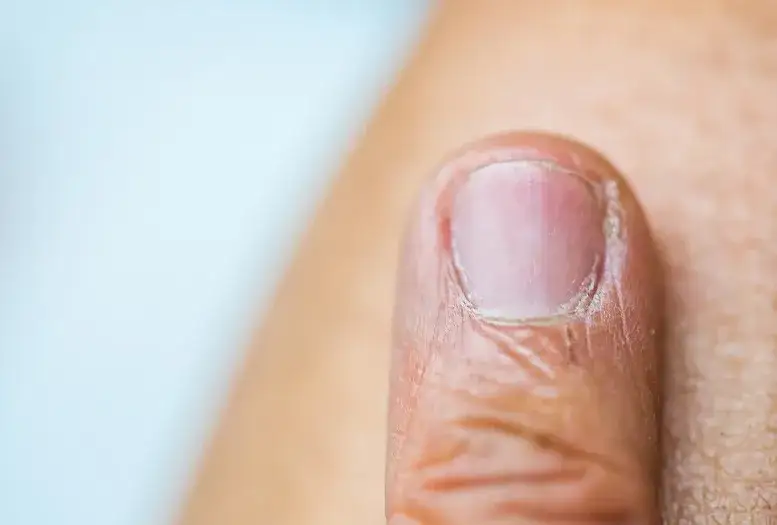 Do jakiego lekarza z paznokciami? Sprawdź, kto pomoże w problemach