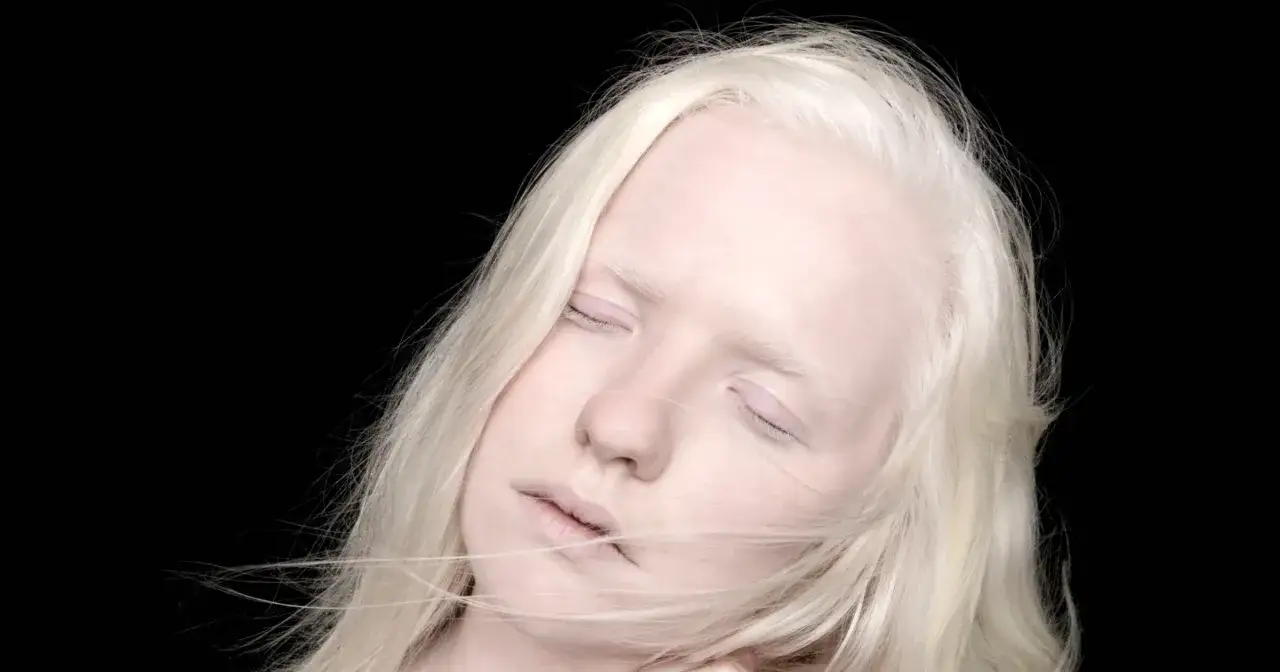 Portret albinosa z blond włosami i zamkniętymi oczami na czarnym tle.