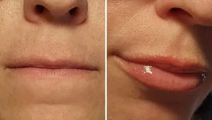 Czy błyszczyk powiększający usta działa? Odkryj prawdę o efektach