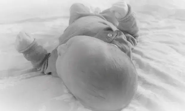 Upadek dziecka z łóżka: Kiedy na SOR, a kiedy obserwować w domu?