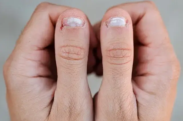 Jak pobudzić macierz paznokcia i przywrócić ich zdrowy wygląd