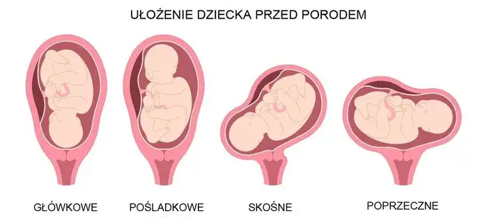 Kiedy dziecko obraca się główką w dół? Poznaj kluczowe informacje