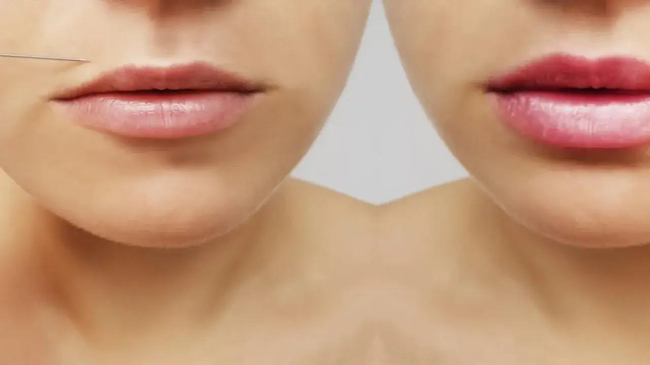 Czym powiększyć usta? Metody, bezpieczeństwo, efekty i ceny