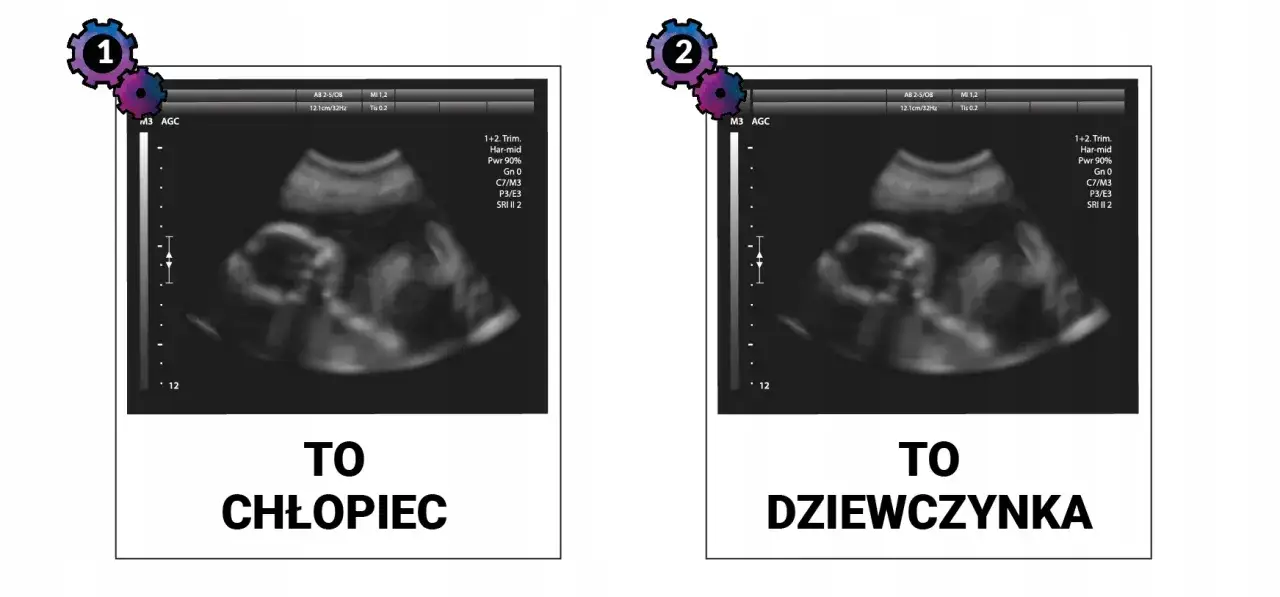Jak rozpoznać płeć dziecka na USG? Kiedy i na co patrzy lekarz?