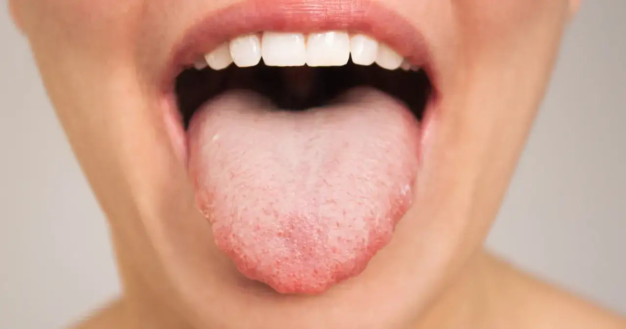 Do jakiego lekarza z językiem? Poznaj specjalistów i ich rolę w zdrowiu