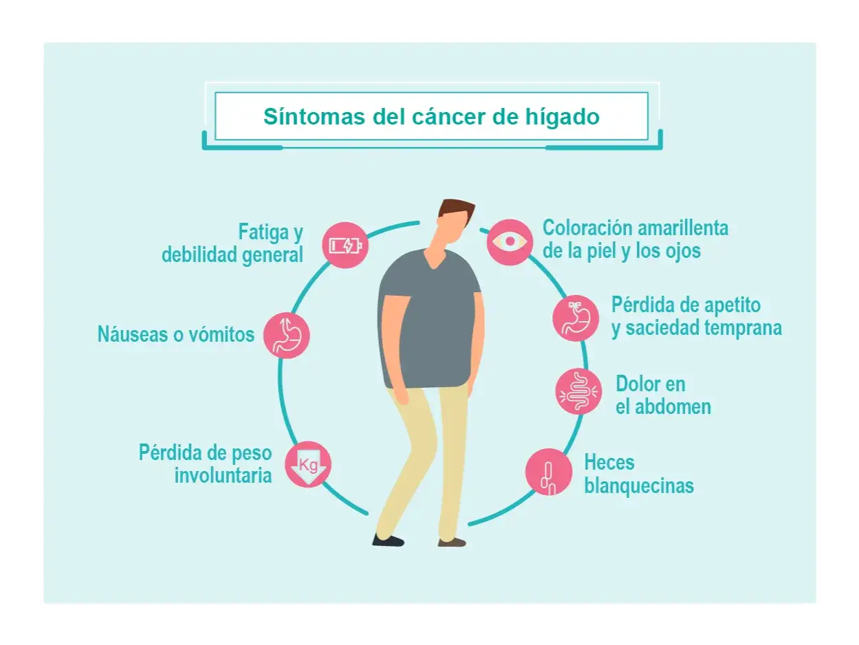 ¿Cáncer de hígado? Conoce sus síntomas y actúa a tiempo