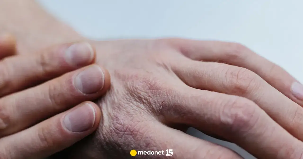 Dezynfekcja: Jak to działa? Unikaj błędów i chroń zdrowie!