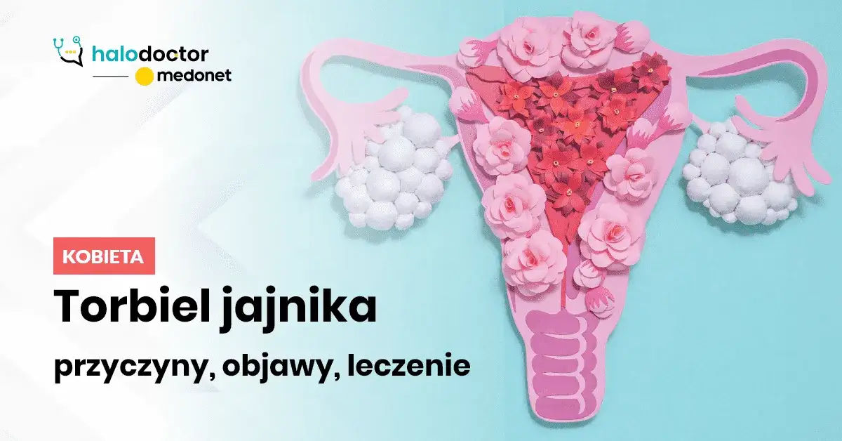 Jakie leki na torbiel jajnika? Skuteczne opcje leczenia i objawy