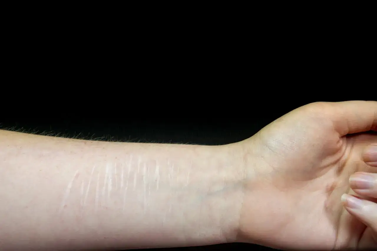 Czy samookaleczanie to grzech ciężki? Perspektywa religijna