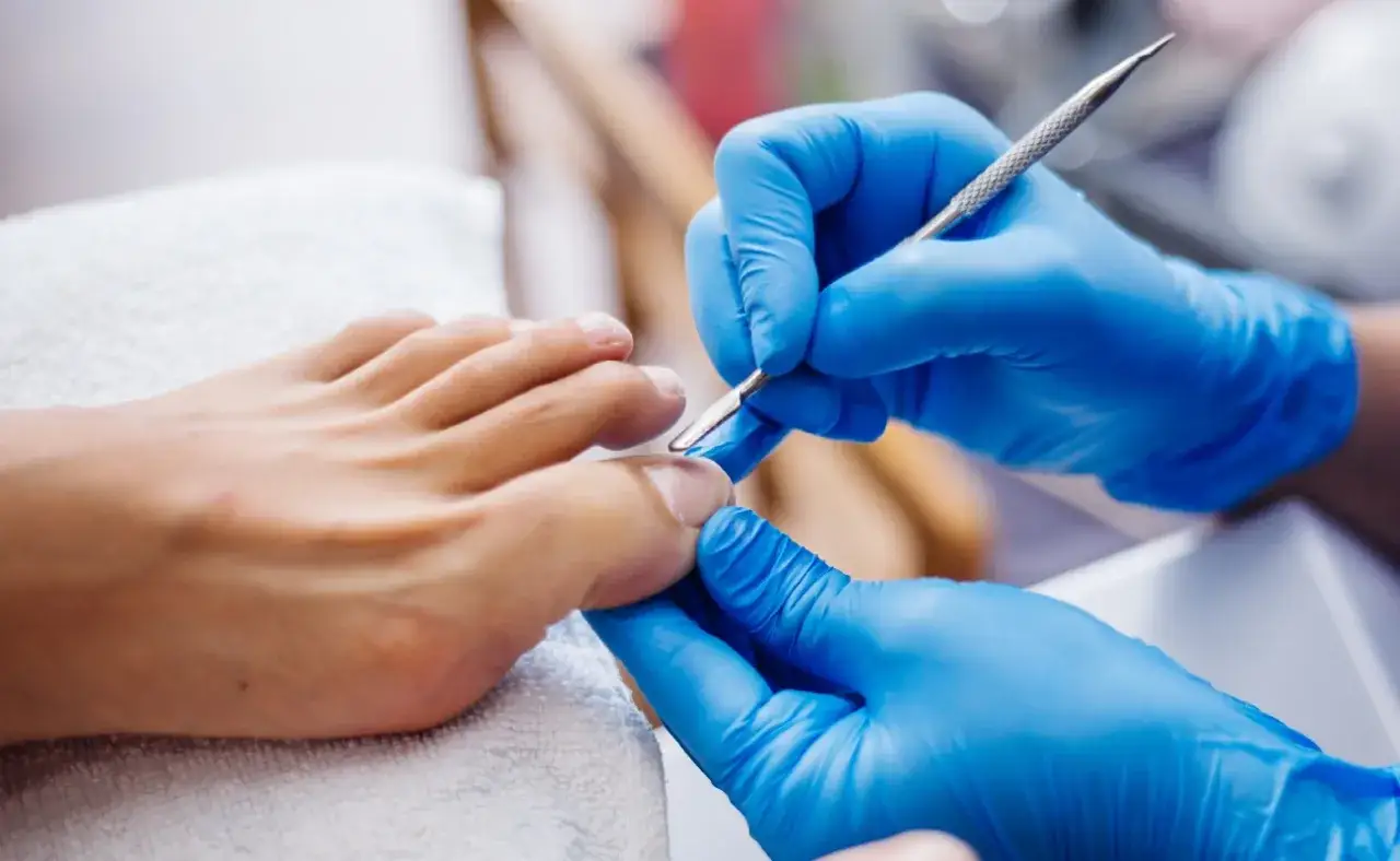 Jak obcinać wrastające paznokcie? Bezpieczny poradnik i kiedy do podologa