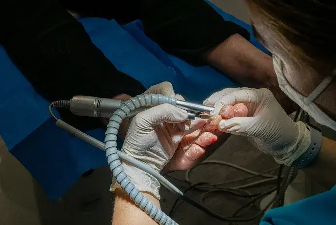 Czy podolog jest na NFZ? Dowiedz się, dlaczego musisz płacić samodzielnie