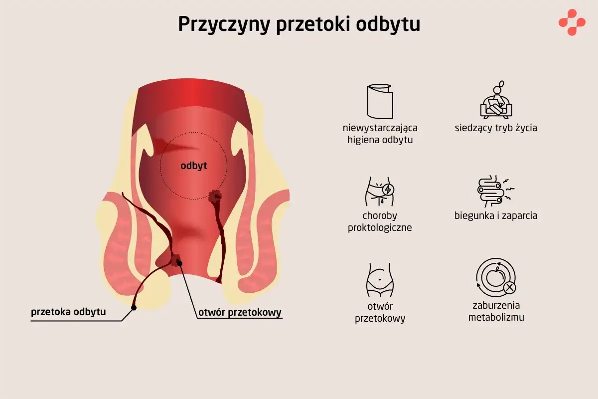 Krew z odbytu: Kiedy do proktologa, a kiedy na SOR?