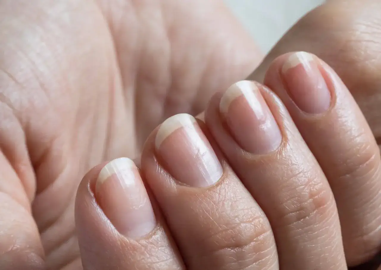 Jak odrasta paznokieć po zerwaniu? Pełny przewodnik regeneracji