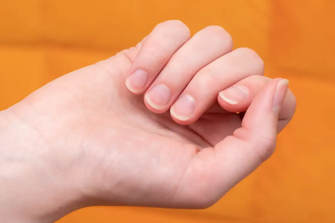 Zanokcica jaki lekarz - jak znaleźć odpowiedniego specjalistę?