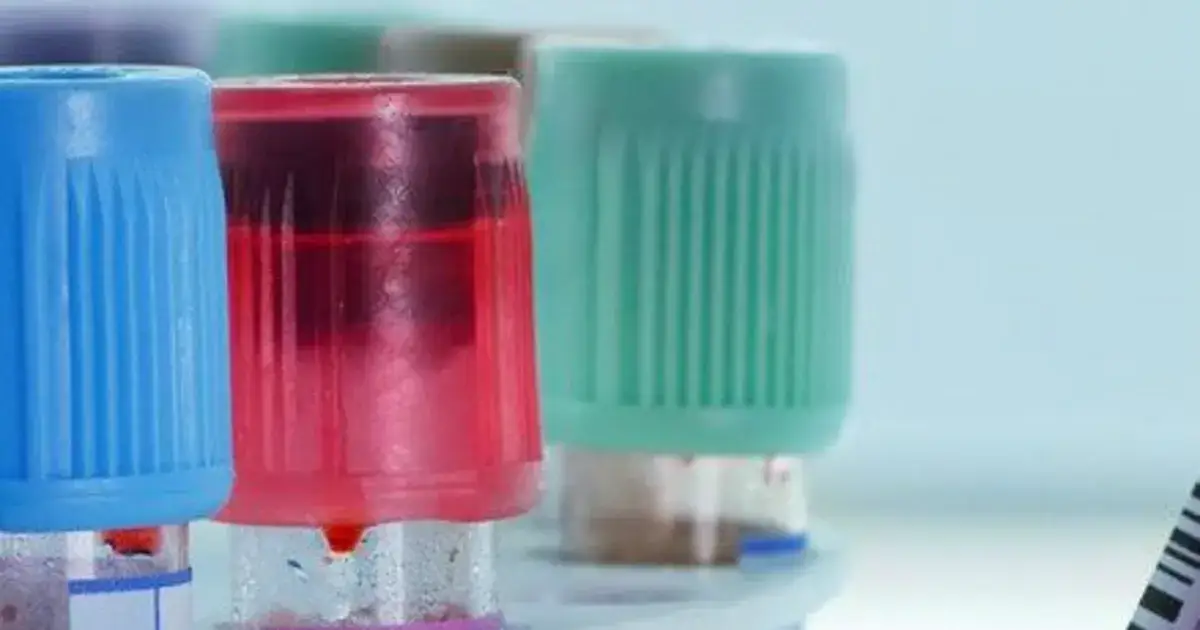 Podwyższony poziom NSE - co oznacza i kiedy powinieneś się niepokoić